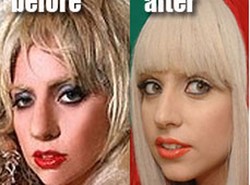 Lady GaGa przed operacją plastyczną