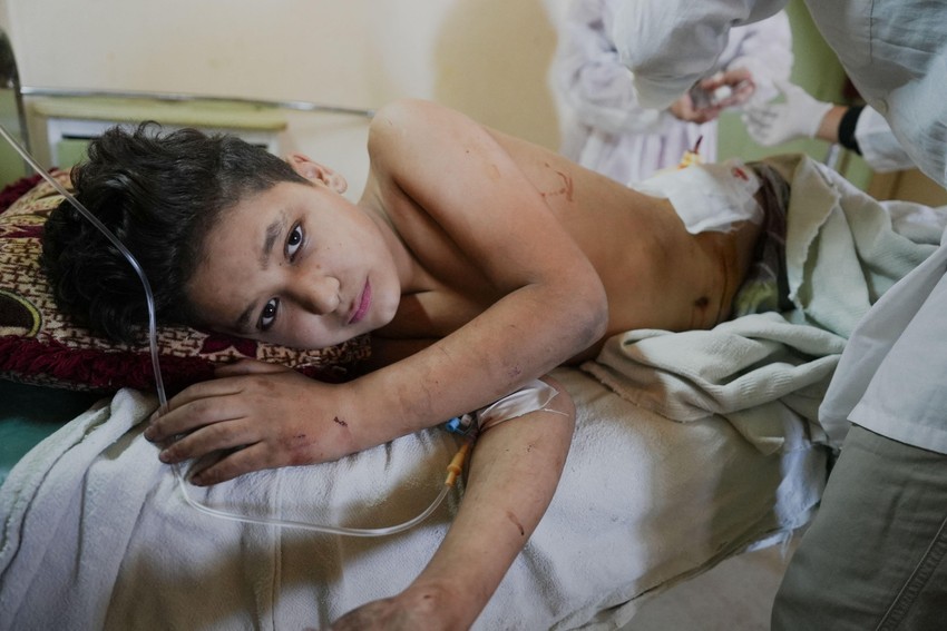 Dečak u bolnici u Siriji nakon masakra Druza u Suvejdi