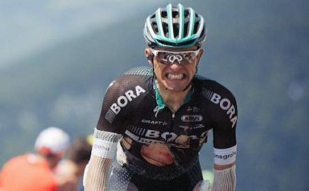 Rafał Majka po kraksie w czasie Tour de France / zdjęcie z profilu zawodnika