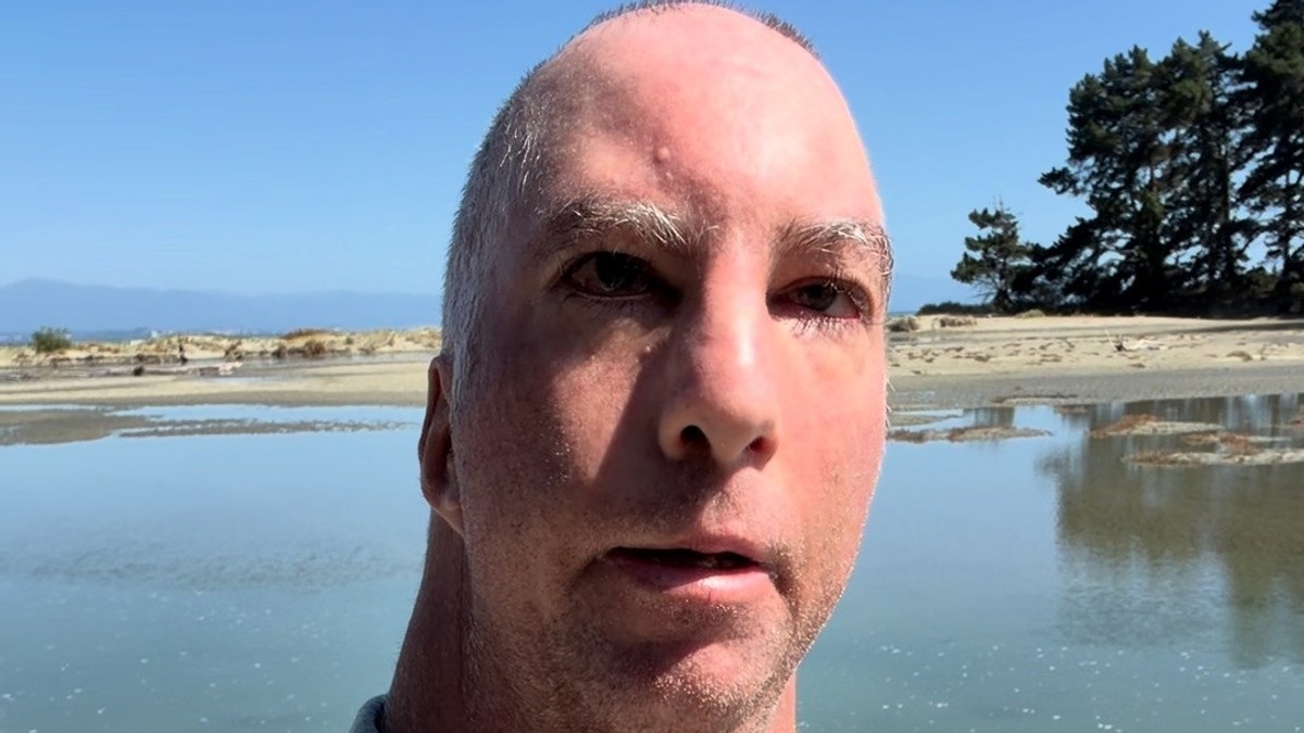 Danijel ima redak poremećaj, davali su mu 1 dan da preživi, a on napunio 41 godinu