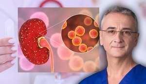 Polipi u želucu javljaju se kod oba pola, kaže prof. dr Milos Bjelović 