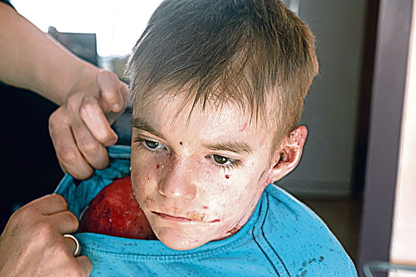 Despotu 
svaki pokret 
izaziva bol