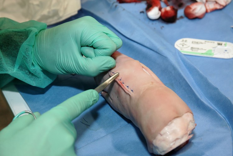 MISTRZOSTWA POLSKI W SZYCIU CHIRURGICZNYM