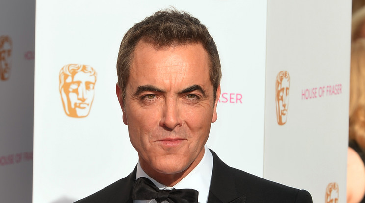 James Nesbitt pár éve még látványosan kopaszodott / Fotó: Northfoto