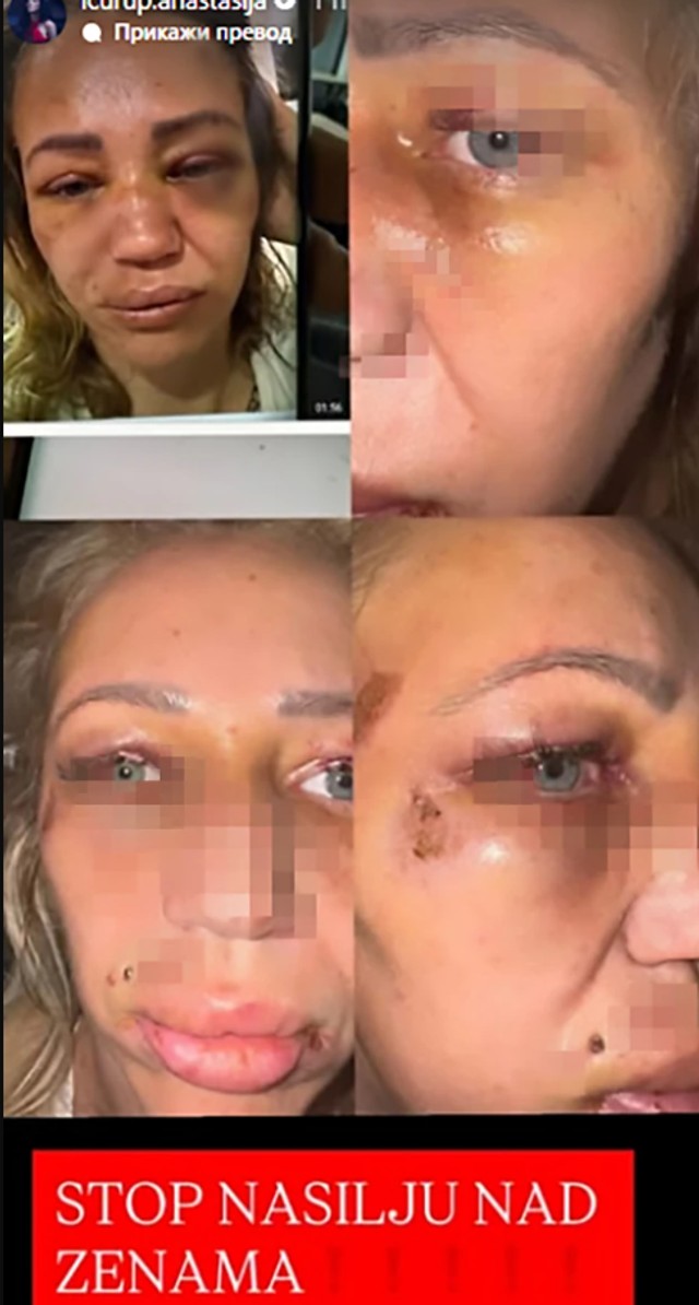 Pevačica se oglasila nakon Kristinine objave o nasilju 