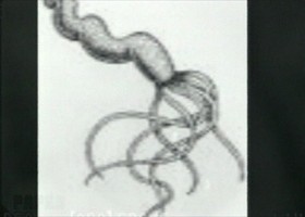 helicobacter-280-d0000091C2ef4484756f6