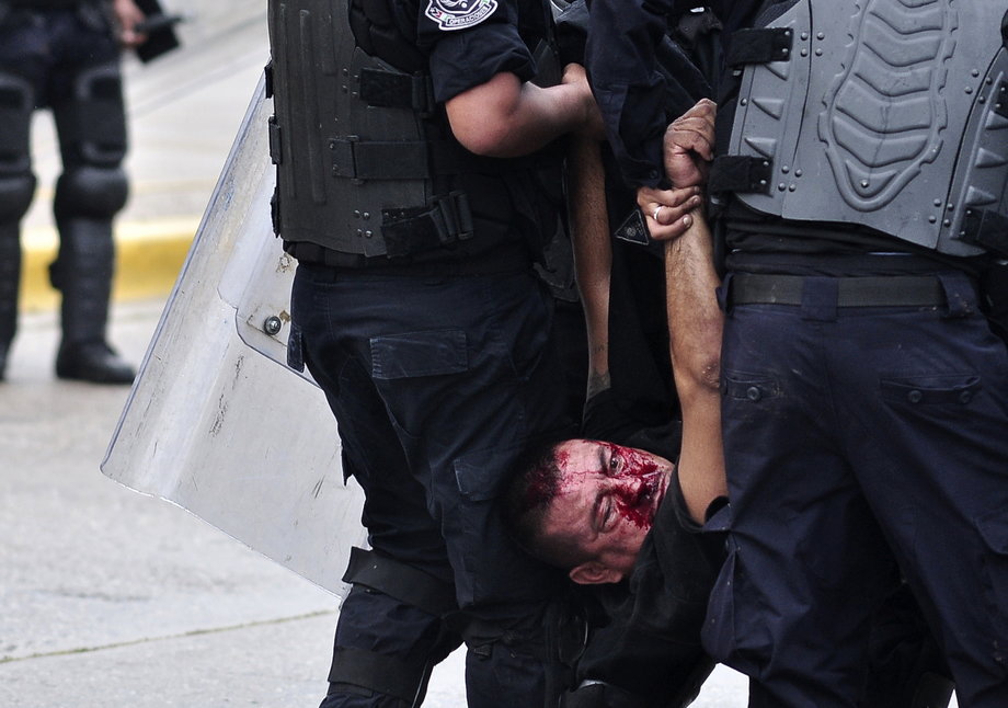 Police officers carry a wounded colleague who was beaten up by rioting protesters during a protest in reprisal for the killing of 43 trainee teachers, in Acapulco, November 10, 2014.
