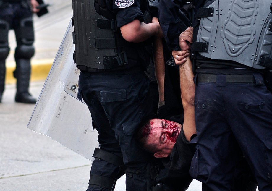 Police officers carry a wounded colleague who was beaten up by rioting protesters during a protest in reprisal for the killing of 43 trainee teachers, in Acapulco, November 10, 2014.