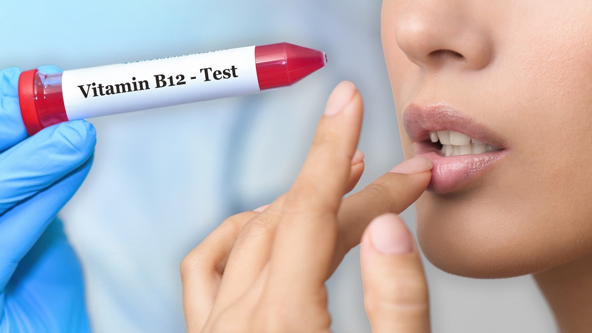 Signali nedostatka vitamina B12 na i u ustima 