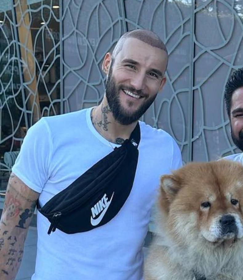 Nemanja Gudelj posle transplatacije kose