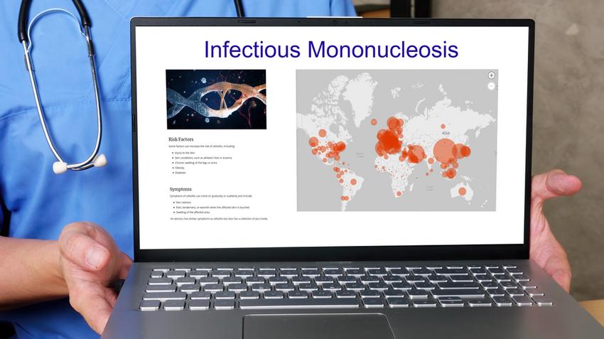 Mononukleózis, Csókbetegség, Mononucleosis infectiosa, tünetei, kezelése, szövődményei, vírusfertőzés, Epstein-Barr, Nyirokcsomó-megnagyobbodás, vírus, fertőzés