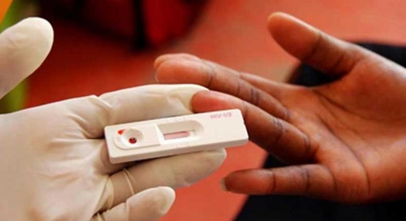 A HIV test kit