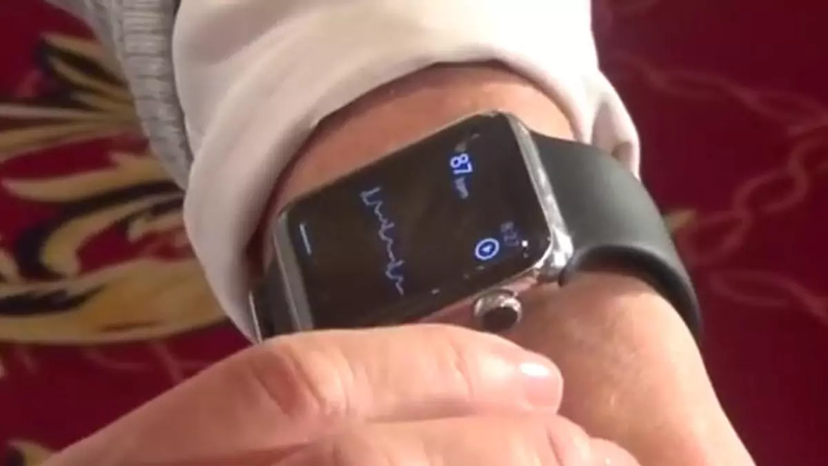 AliveCor prezentuje pasek dla Apple Watcha monitorujący EKG (wideo)