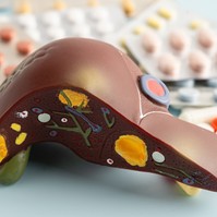 Zsírmáj: visszafordíthatja-e egy egyszerű vitamin a világ leggyakoribb májbetegségét?