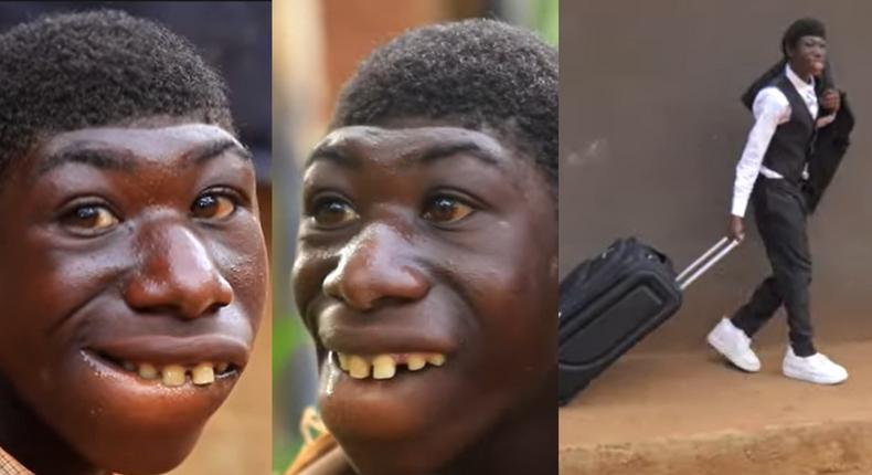 Amazing transformation of 21-year-old man bullied for being born different (video)