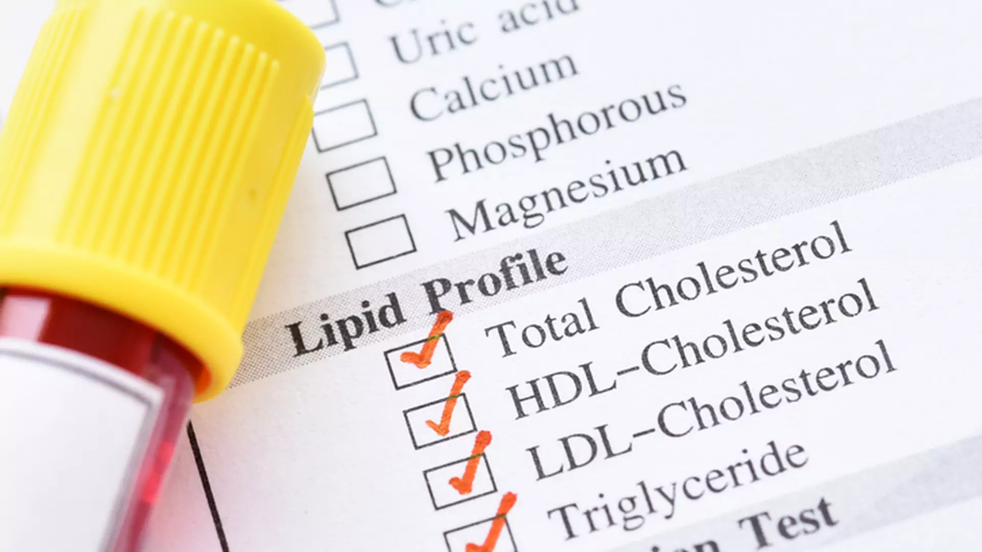 Cholesterol HDL, czyli ten dobry cholesterol