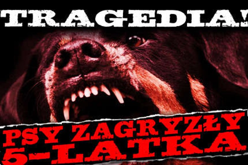 Tragedia! Psy zagryzły 5-latka