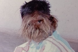 Bio je ubedljivo NAJDLAKAVIJI DEČAK NA SVETU! Ljudi su BEŽALI KAD GA VIDE, a OVO je on danas: Sad bi svi da se druže s njim zbog JEDNOG IZVAVANREDNOG PRIZNANJA