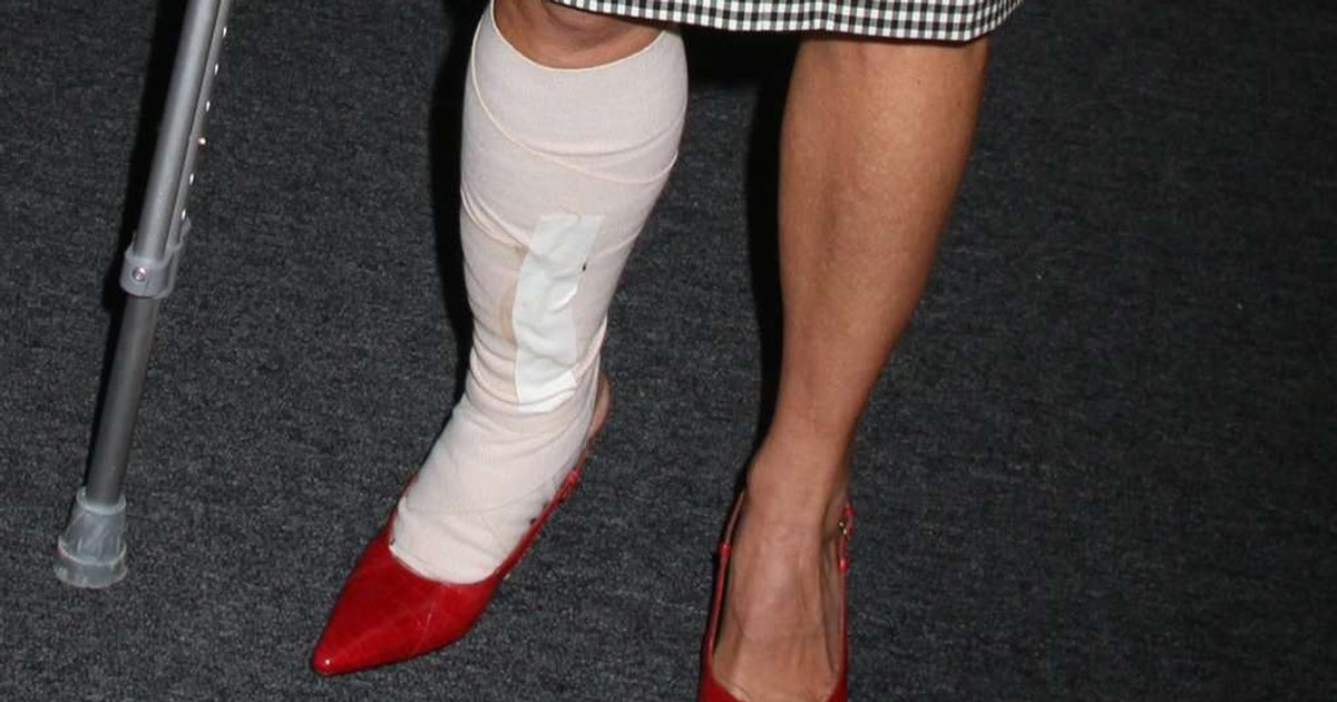 Z gipsem na salonach