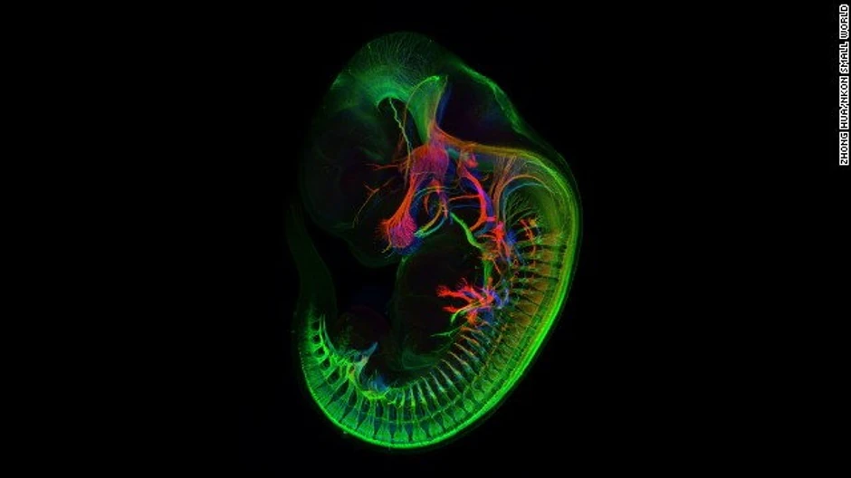 Zong Hua - periferni nervi embriona miša