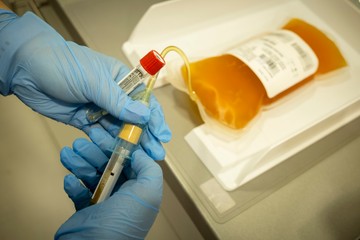 Így néz ki a levett vérplazma, amelyből gyógyszert készítenek