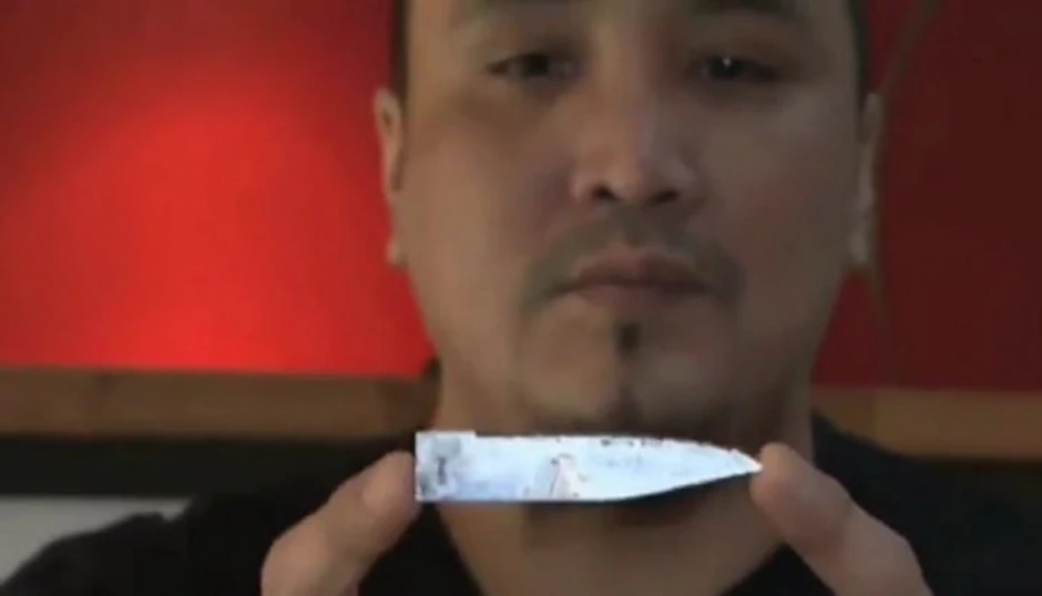 Iz Meknilijevih leđa izvađeno je sečivo dugo sedam centimetara