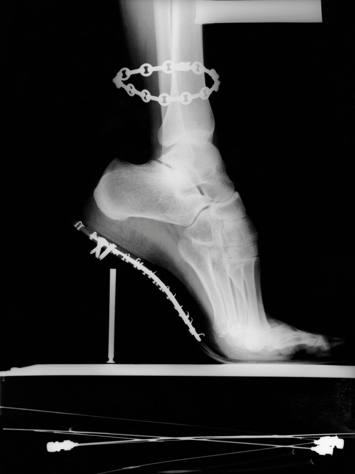 Helmu Newton, "X-Ray, Van Cleefs & Arpels" (francuski "Vogue", Paryż, 1994)