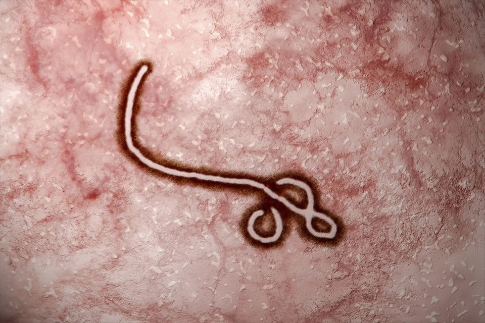 Gorączka krwotoczna Ebola