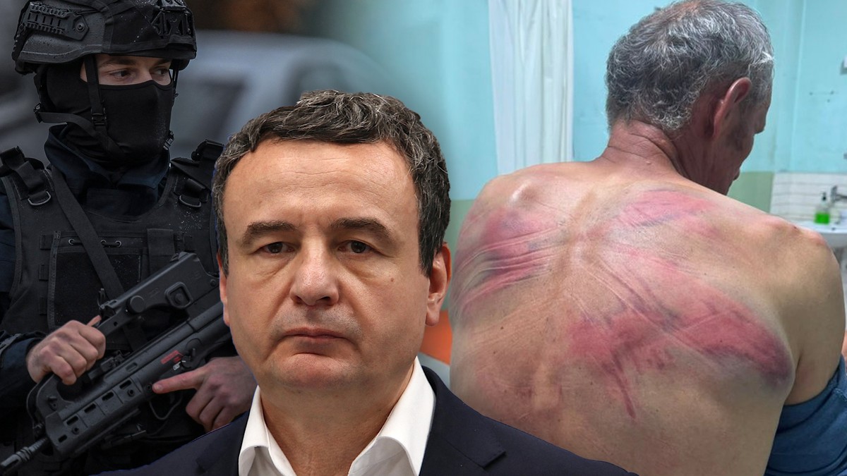 Kurti, prebijeni Nenad Rašković 