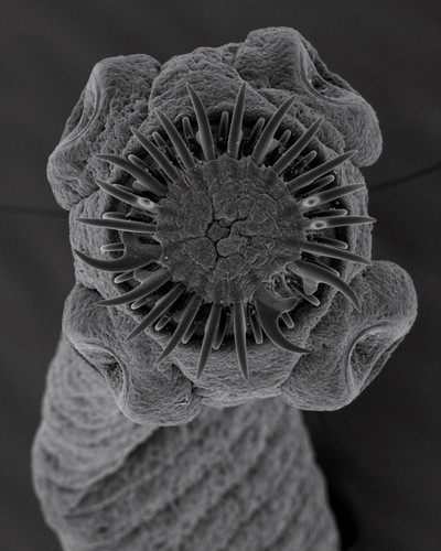 Taenia solium – tasiemiec potrafi wyprodukować nawet 250 000 jaj i złożyć je w ciele swojego ostatecznego żywiciela, którym jest człowiek