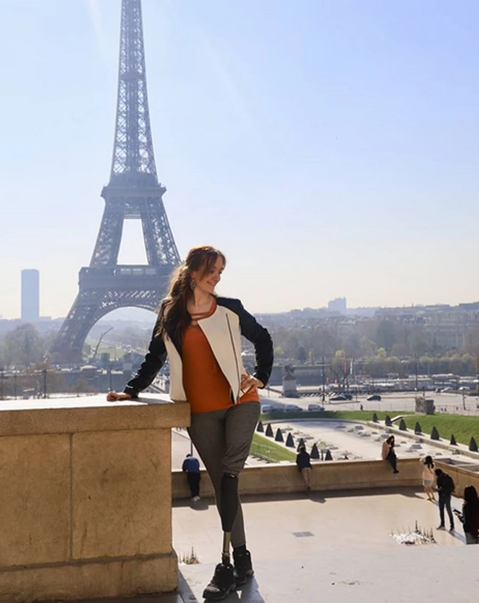 Bojana Ćorilić (24), devojka kojoj je amputirana noga, nakon što je kao slučajna prolaznica upucana tokom masakra u Žitištu, 2. jula 2016. godine.