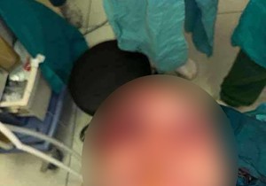 Lovočuvar kojeg je napala mečka