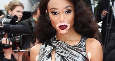 Winnie Harlow olyan erotikus fenékrázást nyomott, hogy csoda, hogy nem tiltotta le az Instagram