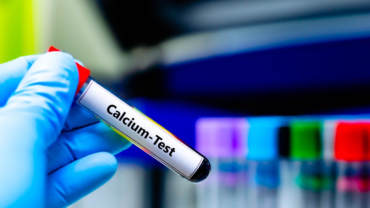 Hipokalcemija se dijagnostikuje ako je ukupna koncentracija kalcijuma u serumu (krvi) manja od 8,8 mg/dl