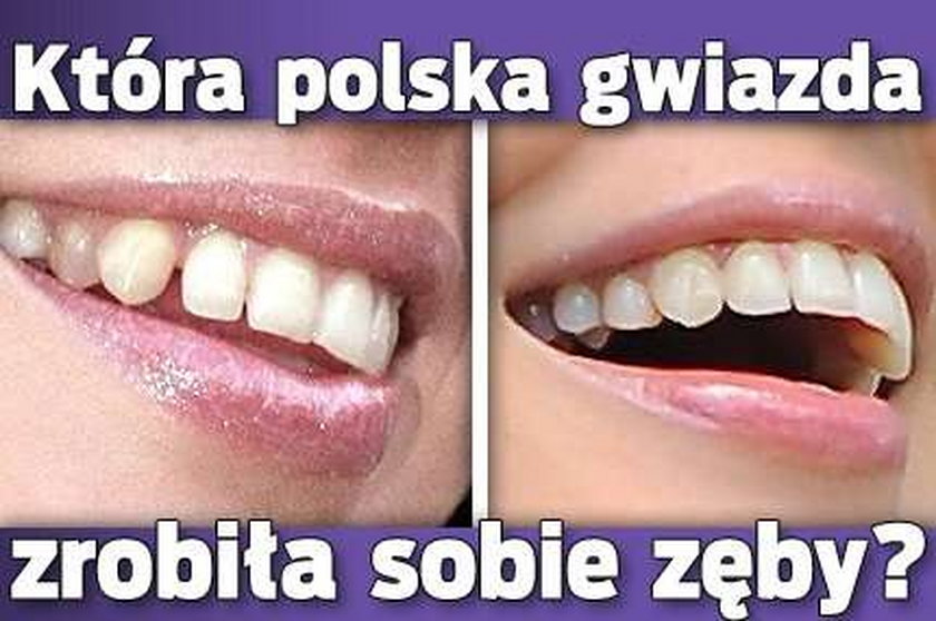 Która polska gwiazda zrobiła sobie zęby?