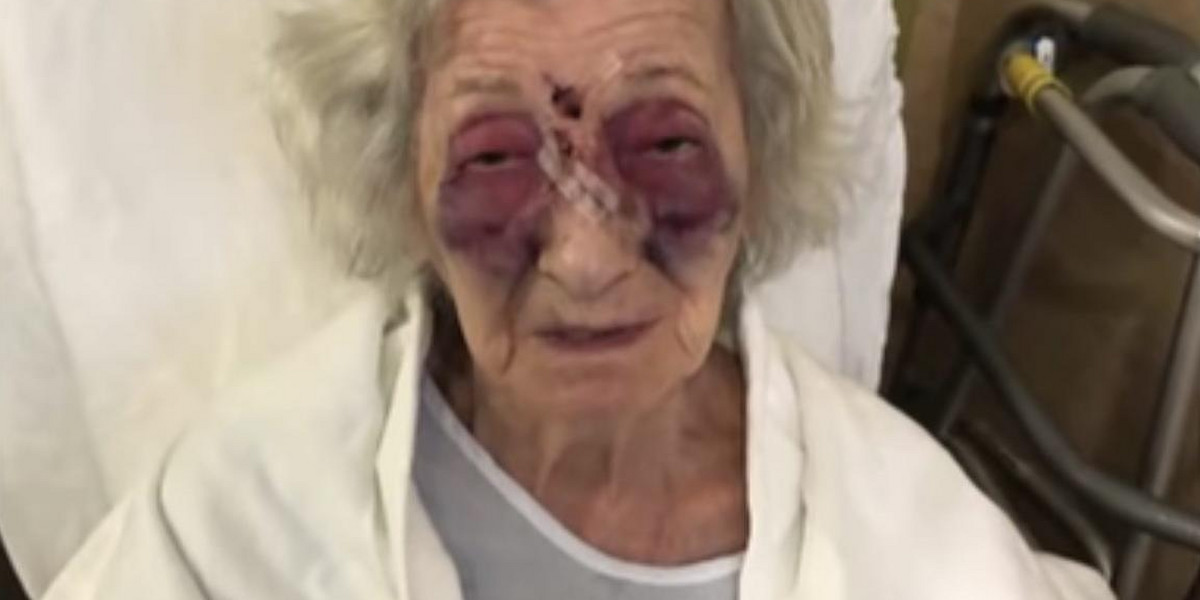 92-letnia staruszka brutalnie dotkliwie pobita.