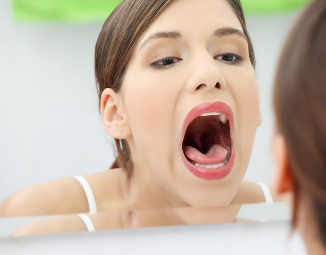 4.	Co zdradzą plamy na zębach?