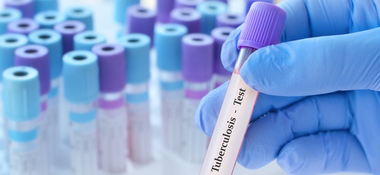 Gruźlica w szkole. Nauczycielka mogła zarazić kilkuset uczniów