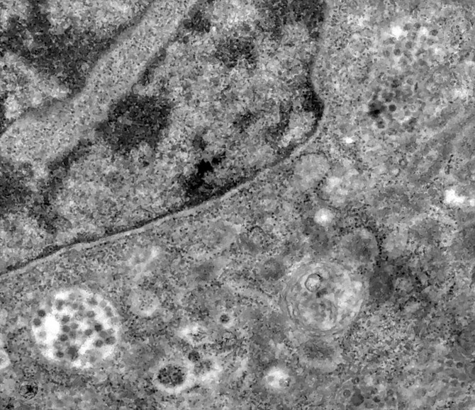 Virus i citoplazma ćelije