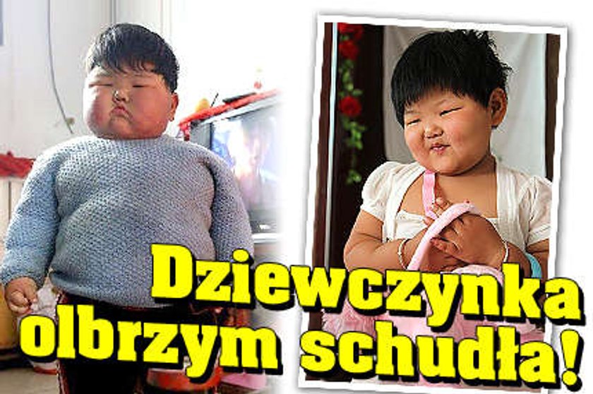 Dziecko olbrzym schudło!