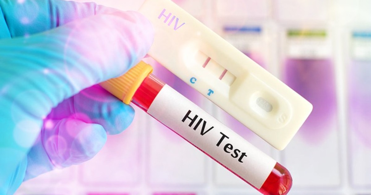 Over 20,000 Ghanaians test positive for HIV in first half of 2022