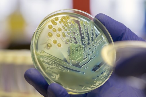 Microbiologist examining a multi-drug resistant coliform (Klebsiella pneumoniae) bacteria on CLED ag