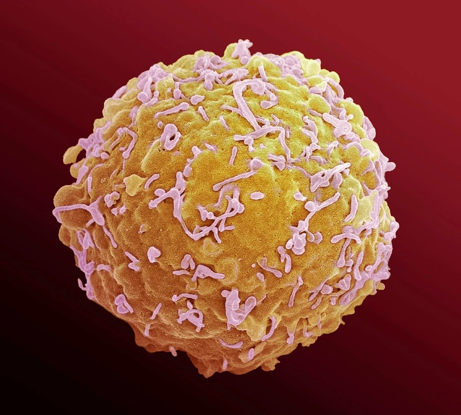 Ćelija imunog sistema