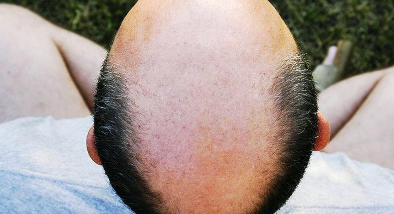 7 Ways to Slow Down Hair Loss