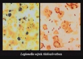 sejtek-280-d000008B3942b21217ea7
