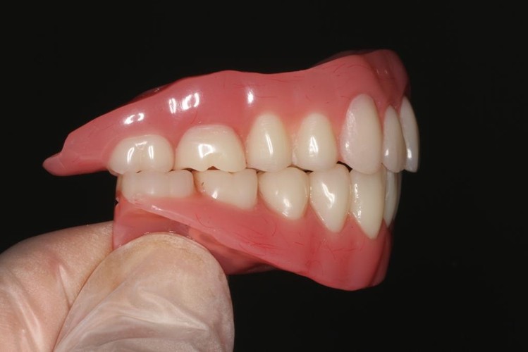 Problem z zakładaniem