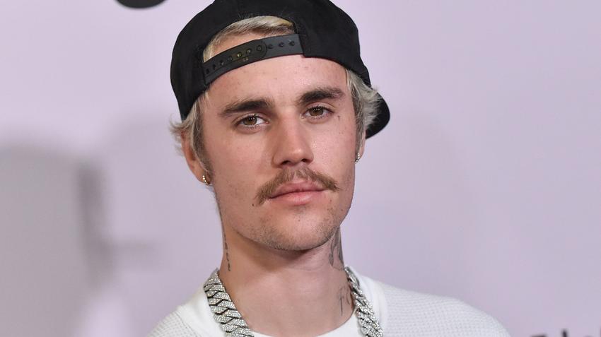 varicella zoster, övsömör, bárányhimlő, justin bieber