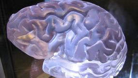 Ludzkie mózgi staja się coraz większe? Nie mądrzejemy, ale przynajmniej jesteśmy zdrowsi