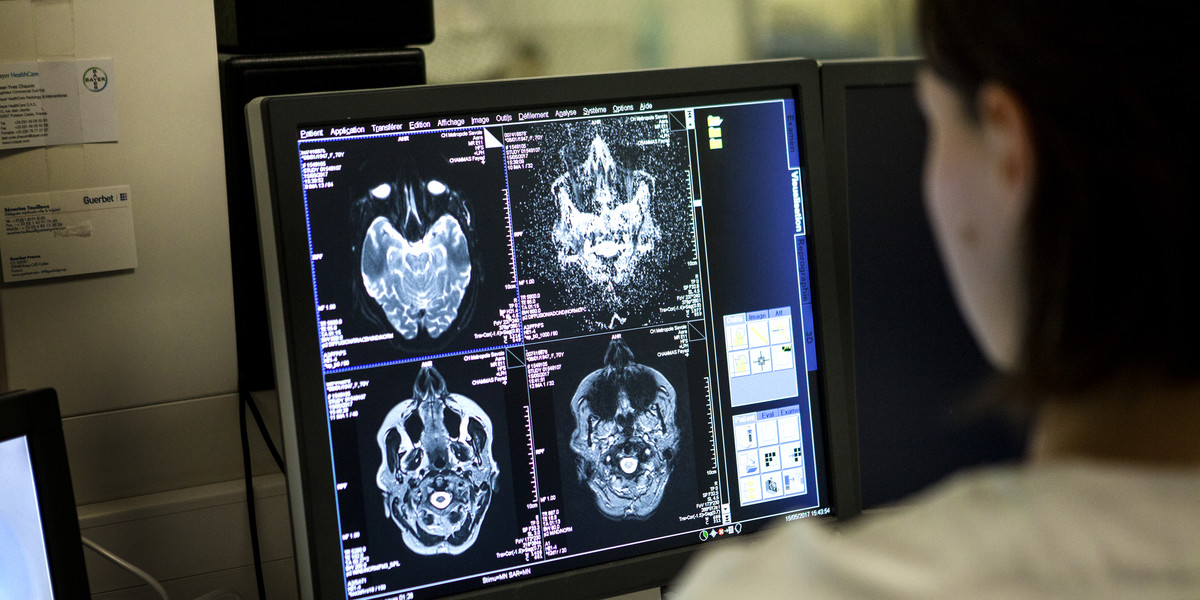 Usługa obrazowania medycznego w szpitalu w Savoie we Francji. Technik monitoruje sesję rezonansu magnetycznego mózgu