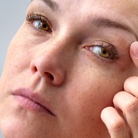 Fáradtság és stressz: ezt teszi a szemhéj izmaival - ebben az esetben forduljon szakorvoshoz